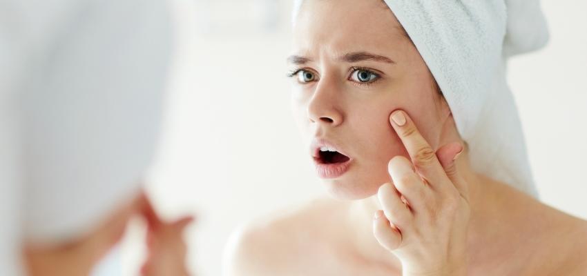 Is Your Acne The Cystic Acne? Know More